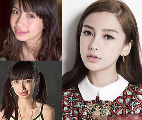 angelababy整容前后照片