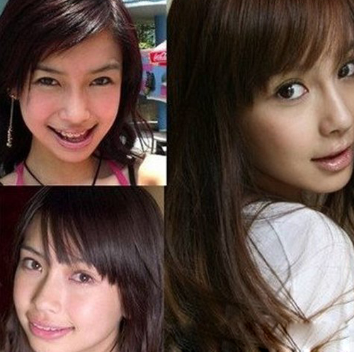 angelababy整容前后照片