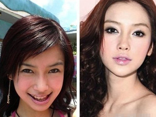 angelababy整容前后照片