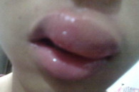 24岁女孩对精液过敏 给男友口交后肿成香肠嘴!