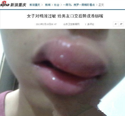 24岁女孩对精液过敏 给男友口交后肿成香肠嘴!.jpg