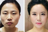 韩国鬼斧神工的整容技术最新版。