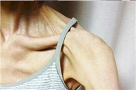 搞笑图片：妹子们不是喜欢瘦吗 赐你这样的身材怎么样?