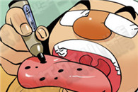 少女少男邪恶漫画大全集：最新整形美容方式 祛痣。